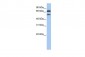 FBXO7 antibody - middle region